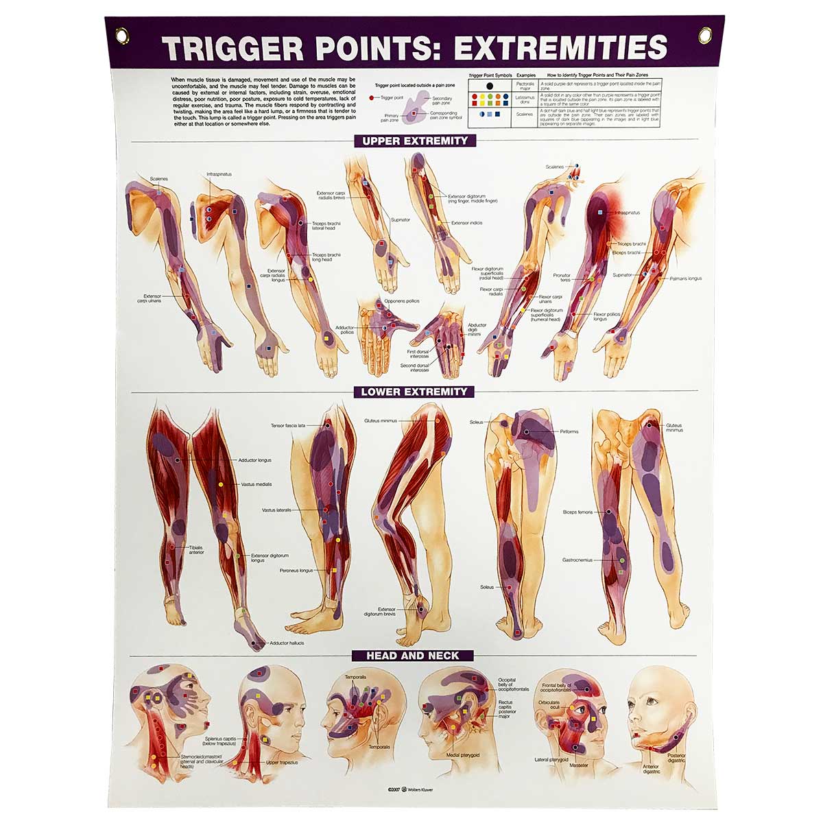 Trigger Points Extremities Chart Relaxus Professional