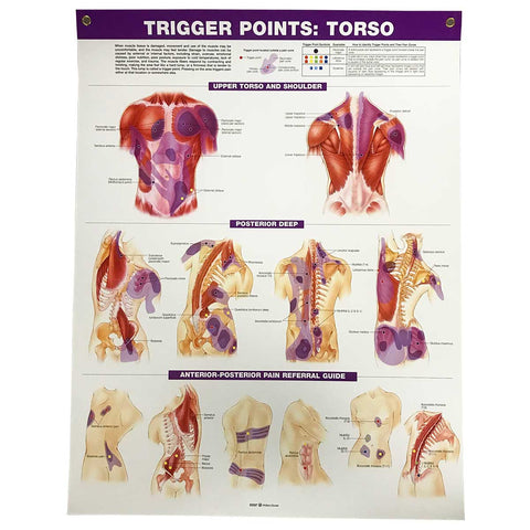 Trigger Points: Extremities Chart